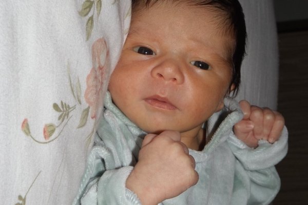 Cuidados com a pele do recém-nascido